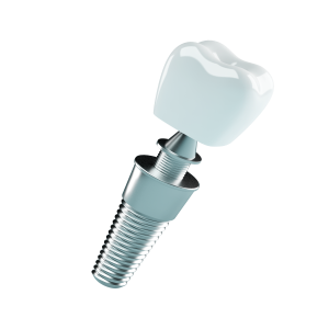 Dental Implant